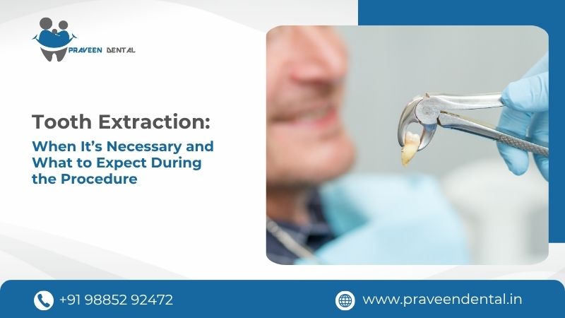Tooth Extraction: When It’s Necessary and What to Expect During the Procedure