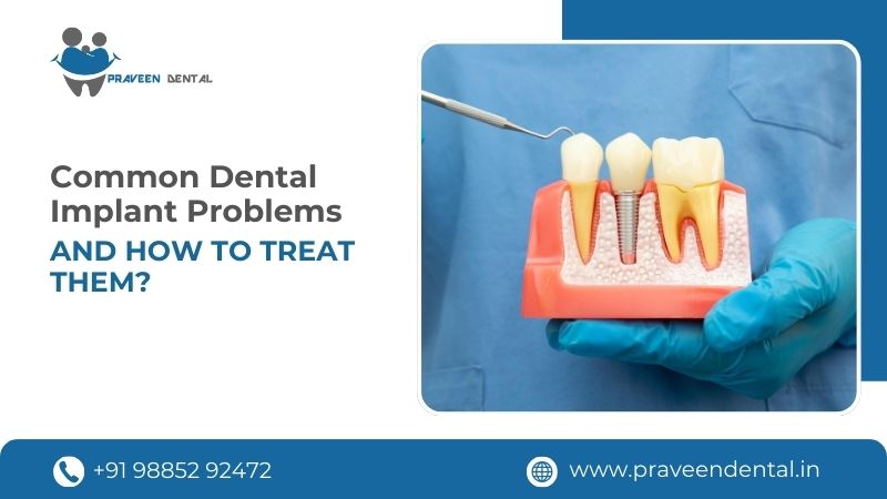 Common Dental Implant Problems And How To Treat Them?