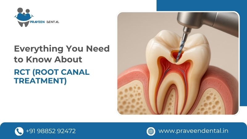 Everything You Need to Know About Root Canal Treatment