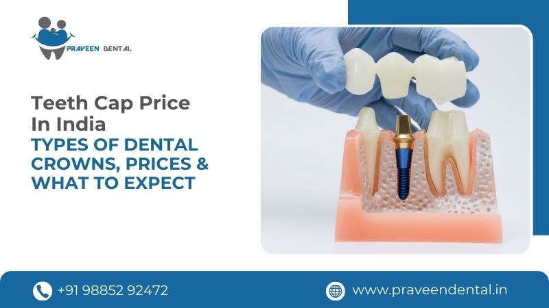 Teeth Cap Price in India: Types of Dental Crowns, Prices & What to Expect